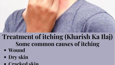 Treatment of itching (Kharish Ka Ilaj)
