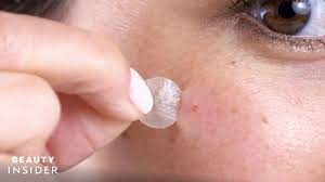 Pimple Patches