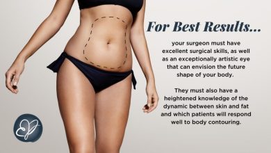 liposuction results